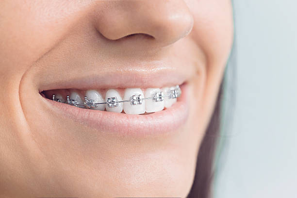 Professional Dental Services in North Canton, OH